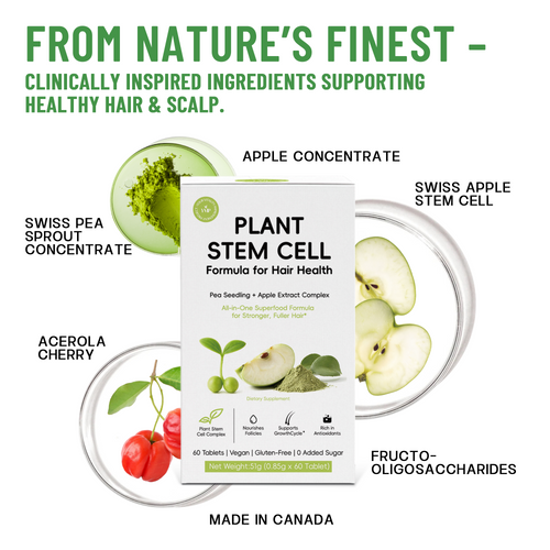 YVIP Hair Nourishing Supplement – Supports Healthy Hair Growth– 6-Box Bundle